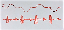 Signature current waveform of the arc current