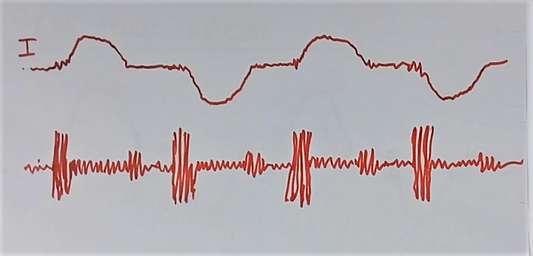 Current signature of electric arc